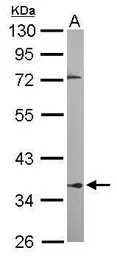 Anti-PPP2R4 antibody [N2C3] used in Western Blot (WB). GTX105724