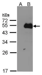 Anti-NFIB antibody [N1C2] used in Western Blot (WB). GTX105749