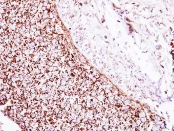 Anti-GLUD1 + GLUD2 antibody used in IHC (Paraffin sections) (IHC-P). GTX105765