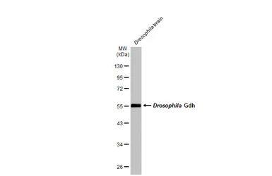 Anti-GLUD1 + GLUD2 antibody used in Western Blot (WB). GTX105765