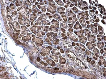 Anti-NDUFS3 antibody used in IHC (Paraffin sections) (IHC-P). GTX105835