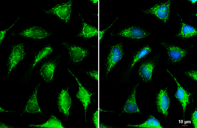 Anti-NDUFS3 antibody used in Immunocytochemistry/ Immunofluorescence (ICC/IF). GTX105835