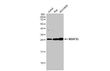 Anti-NDUFS3 antibody used in Western Blot (WB). GTX105835