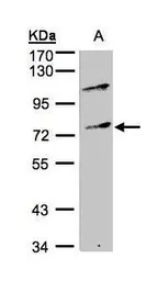 Anti-ZNF42 antibody [N2C1], Internal used in Western Blot (WB). GTX105837