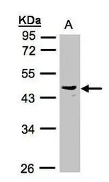 Anti-PSG6 antibody [N1C2] used in Western Blot (WB). GTX105839