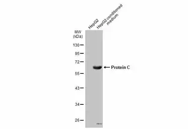 Anti-Protein C antibody used in Western Blot (WB). GTX105844