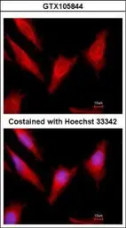 Anti-Protein C antibody used in Immunocytochemistry/ Immunofluorescence (ICC/IF). GTX105844