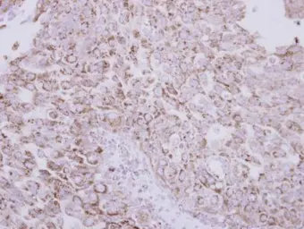 Anti-Protein C antibody used in IHC (Paraffin sections) (IHC-P). GTX105844