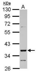 Anti-DMRT1 antibody used in Western Blot (WB). GTX105908