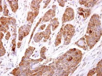 Anti-TBCC antibody [N1C3] used in IHC (Paraffin sections) (IHC-P). GTX105962