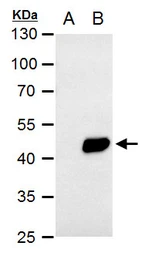 Anti-Pyruvate dehydrogenase kinase 1 / PDK1 antibody [N1C3] used in Western Blot (WB). GTX105999