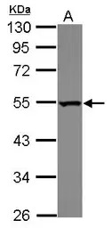 Anti-BAT1 antibody [N1C3] used in Western Blot (WB). GTX106001