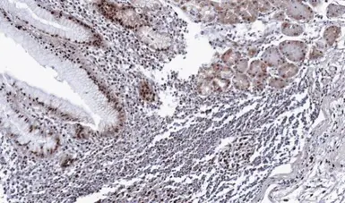 Anti-BAT1 antibody [N1C3] used in IHC (Paraffin sections) (IHC-P). GTX106001