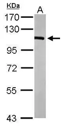 Anti-alpha 1 Catenin antibody used in Western Blot (WB). GTX106014