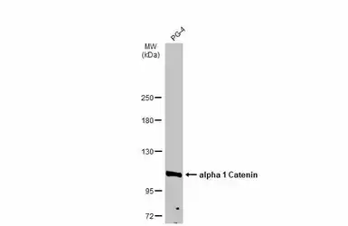 Anti-alpha 1 Catenin antibody used in Western Blot (WB). GTX106014