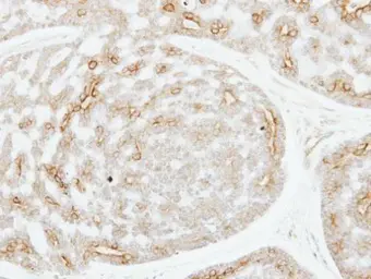 Anti-ADPGK antibody [N2C3] used in IHC (Paraffin sections) (IHC-P). GTX106029