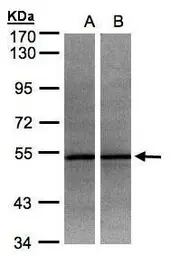 Anti-ADPGK antibody [N2C3] used in Western Blot (WB). GTX106029