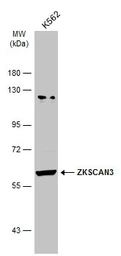 Anti-ZKSCAN3 antibody [N1C2] used in Western Blot (WB). GTX106039