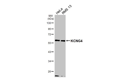 Anti-KCNG4 antibody used in Western Blot (WB). GTX106058