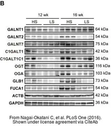 Anti-GALNT7 antibody [N1C2] used in Western Blot (WB). GTX106068