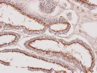 Anti-GALNT7 antibody [N1C2] used in IHC (Paraffin sections) (IHC-P). GTX106068