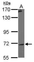 Anti-GALNT7 antibody [N1C2] used in Western Blot (WB). GTX106068