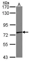 Anti-GALNT7 antibody [N1C2] used in Western Blot (WB). GTX106068