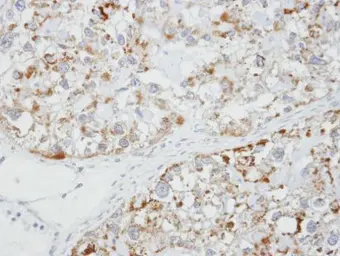 Anti-Glycine Receptor alpha 1 antibody [N1C1] used in IHC (Paraffin sections) (IHC-P). GTX106112