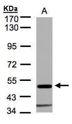 Anti-Glycine Receptor alpha 1 antibody [N1C1] used in Western Blot (WB). GTX106112