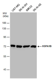 Anti-Hsp70 antibody used in Western Blot (WB). GTX106148