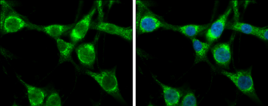 Anti-Hsp70 antibody used in Immunocytochemistry/ Immunofluorescence (ICC/IF). GTX106148