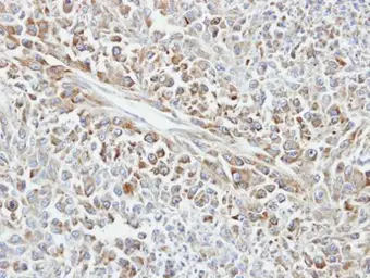 Anti-Hsp70 antibody used in IHC (Paraffin sections) (IHC-P). GTX106148