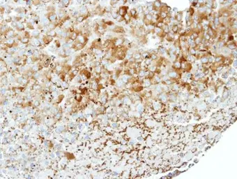 Anti-WNK1 antibody used in IHC (Paraffin sections) (IHC-P). GTX106197