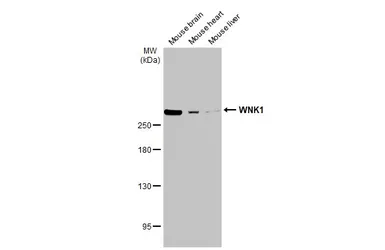 Anti-WNK1 antibody used in Western Blot (WB). GTX106197