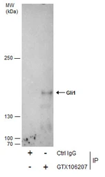 Anti-Gli1 antibody used in Immunoprecipitation (IP). GTX106207