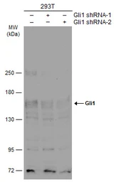 Anti-Gli1 antibody used in Western Blot (WB). GTX106207