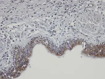 Anti-SHKBP1 antibody [N2C2], Internal used in IHC (Paraffin sections) (IHC-P). GTX106252