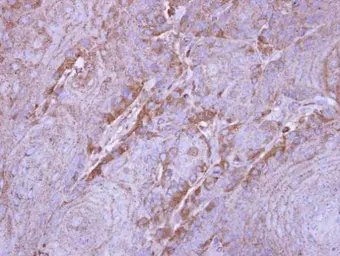 Anti-SIRT3 antibody [C3], C-term used in IHC (Paraffin sections) (IHC-P). GTX106292