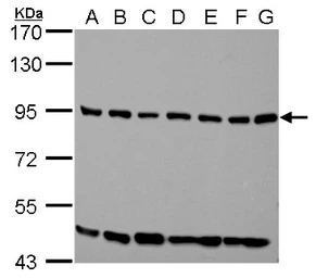 Anti-ELMO1 antibody [C3], C-term used in Western Blot (WB). GTX106301