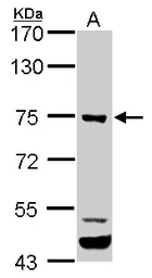 Anti-ELMO1 antibody [C3], C-term used in Western Blot (WB). GTX106301