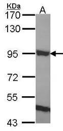 Anti-ELMO1 antibody [C3], C-term used in Western Blot (WB). GTX106301