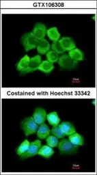 Anti-CENTG3 antibody [C3], C-term used in Immunocytochemistry/ Immunofluorescence (ICC/IF). GTX106308