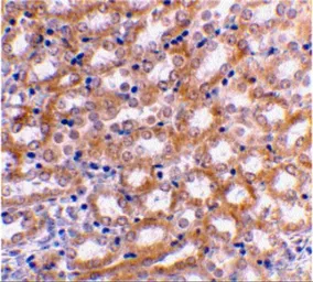 Anti-IRF3 antibody used in IHC (Paraffin sections) (IHC-P). GTX10632