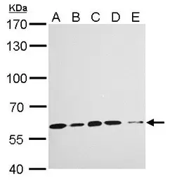 Anti-KPNA4 antibody [C3], C-term used in Western Blot (WB). GTX106325