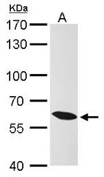 Anti-KPNA4 antibody [C3], C-term used in Western Blot (WB). GTX106325
