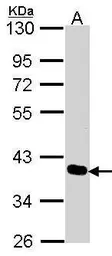 Anti-PDLIM4 antibody [C2C3], C-term used in Western Blot (WB). GTX106353