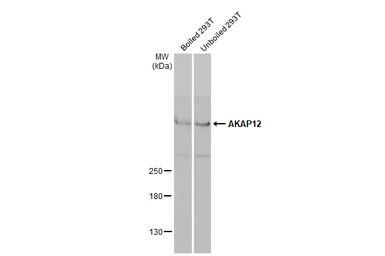 Anti-AKAP12 antibody [C3], C-term used in Western Blot (WB). GTX106373