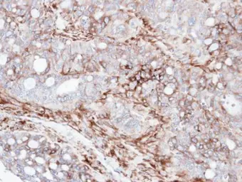 Anti-AKAP12 antibody [C3], C-term used in IHC (Paraffin sections) (IHC-P). GTX106373