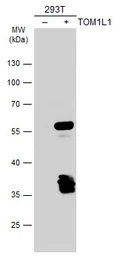 Anti-TOM1L1 antibody [C3], C-term used in Western Blot (WB). GTX106377