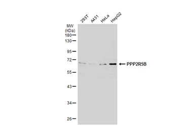 Anti-PPP2R5B antibody [C3], C-term used in Western Blot (WB). GTX106400